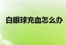 白眼球充血怎么办（如何消除白眼球充血）