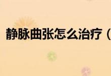 静脉曲张怎么治疗（7个最有效的治疗方法）