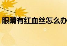 眼睛有红血丝怎么办（消除的几种方法推荐）