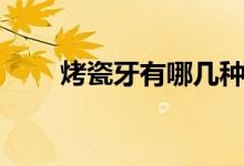 烤瓷牙有哪几种（烤瓷牙种类简述）