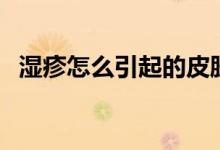 湿疹怎么引起的皮肤痒（湿疹怎么引起的）