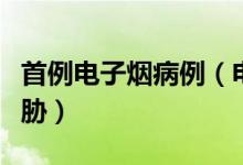 首例电子烟病例（电子烟对市民健康造成了威胁）