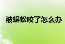 被蜈蚣咬了怎么办（被蜈蚣咬了处理办法）