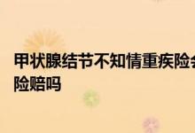 甲状腺结节不知情重疾险会赔吗 甲状腺结节投保不告知重疾险赔吗