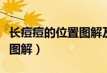 长痘痘的位置图解及如何面对（长痘痘的位置图解）