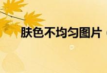 肤色不均匀图片（肤色不均匀怎么办）