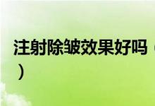 注射除皱效果好吗（注射除皱哪种方式比较好）