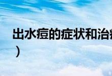 出水痘的症状和治疗（出水痘的症状（图文））