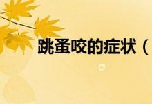 跳蚤咬的症状（被跳蚤咬了怎么办）