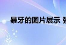  暴牙的图片展示 强烈推荐几种矫正方法 