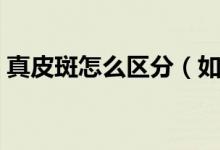真皮斑怎么区分（如何区分表皮斑和真皮斑）
