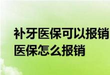 补牙医保可以报销吗 刷医保卡等于报销了吗医保怎么报销 